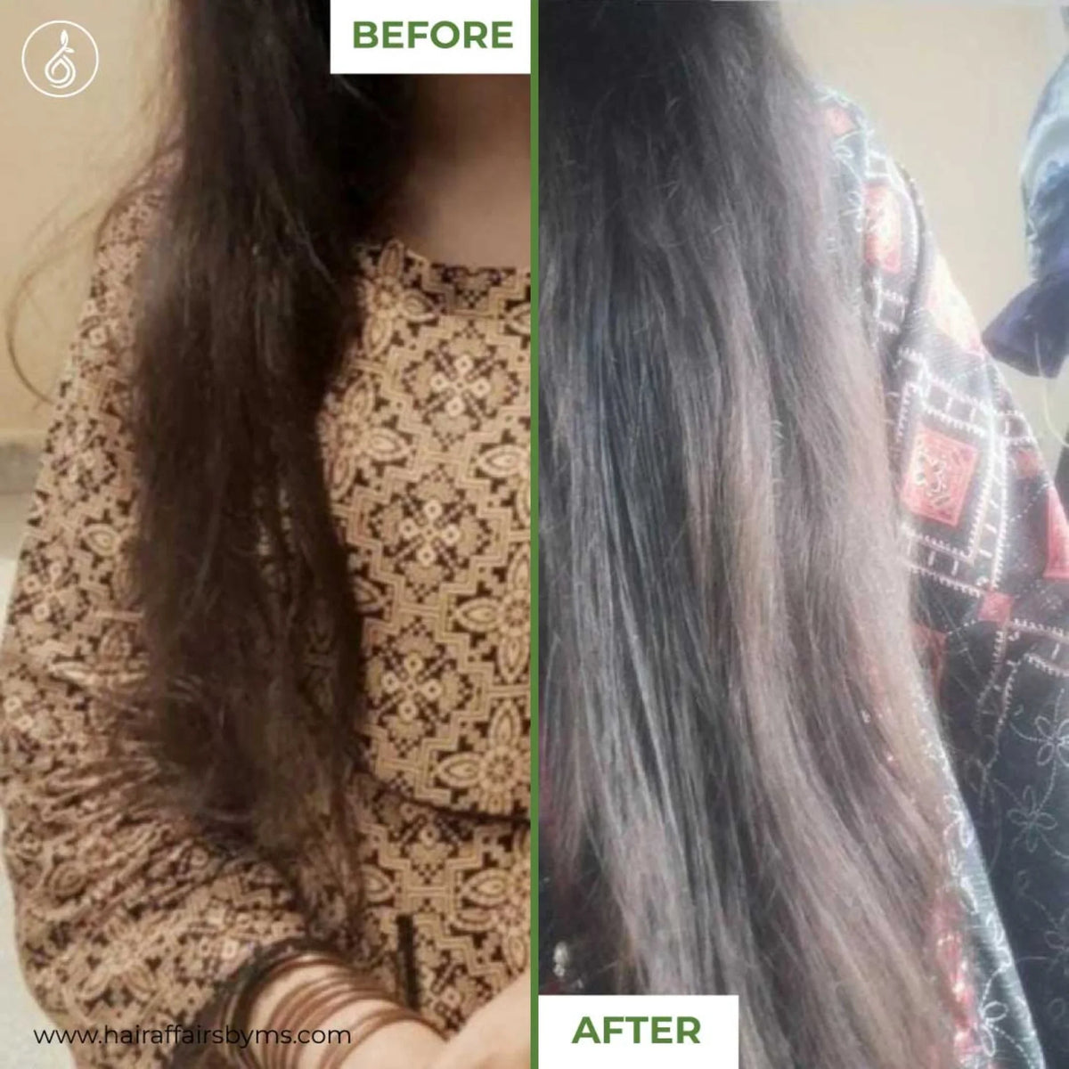 Hairfall Hairgrowth